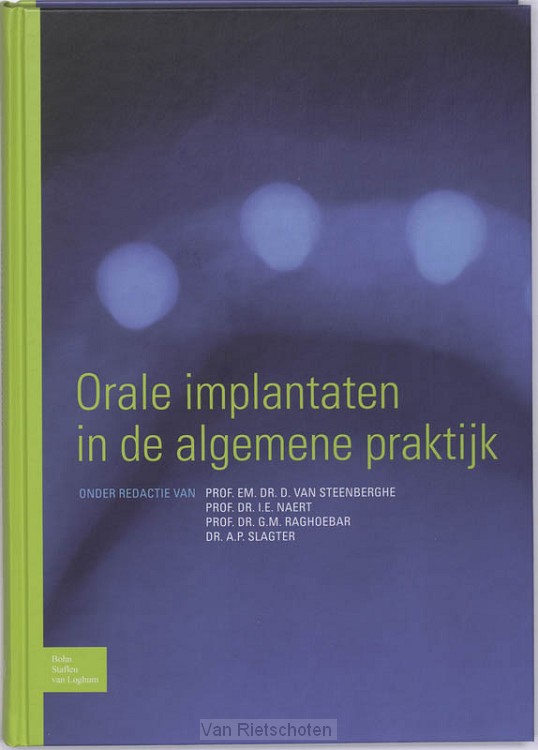 Orale implantaten in de algemene praktijk