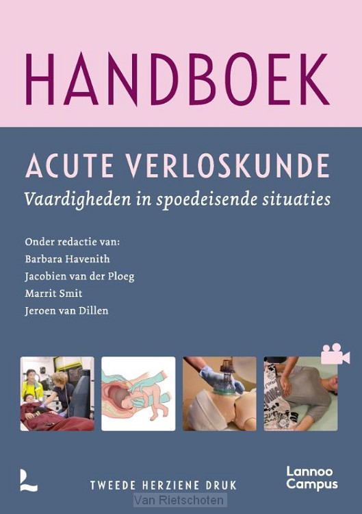 Handboek acute verloskunde